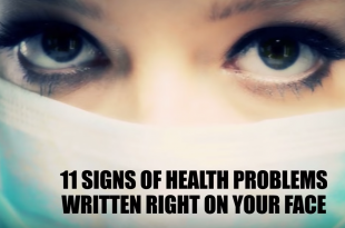 Health Problems Hidden On Your Face