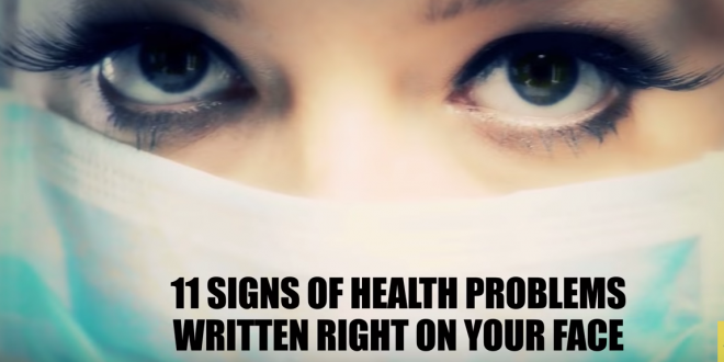 Health Problems Hidden On Your Face